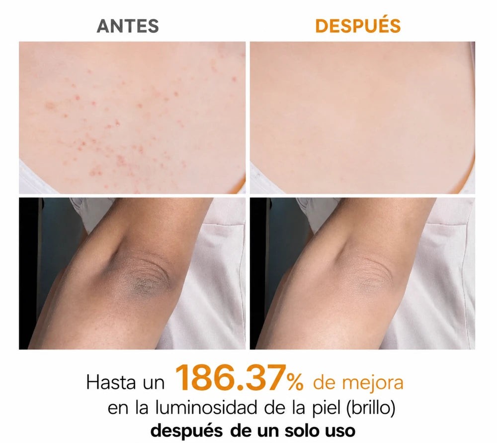 Dr. Melaxin - Spray Exfoliante para Manchas y Piel Opaca